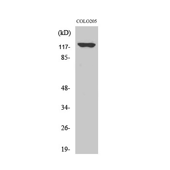  Western Blot analysis of COLO205 cells using A Cyclase I Polyclonal Antibody
