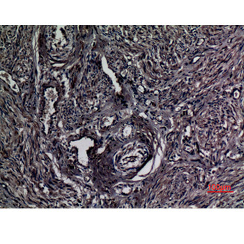  Immunohistochemical analysis of paraffin-embedded human-uterus, antibody was diluted at 1:100