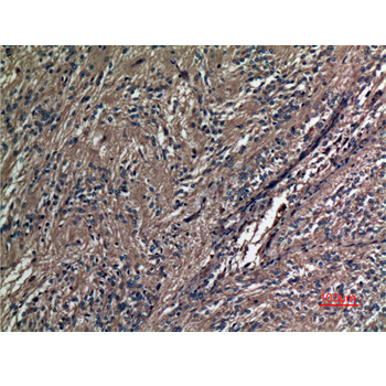  Immunohistochemical analysis of paraffin-embedded human-ovary, antibody was diluted at 1:100