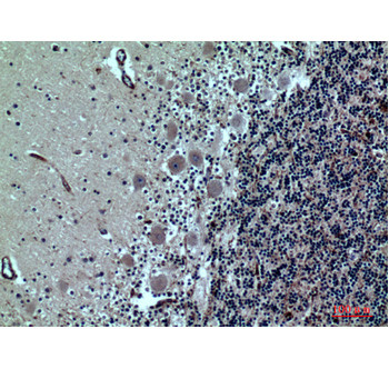  Immunohistochemical analysis of paraffin-embedded human-brain, antibody was diluted at 1:100