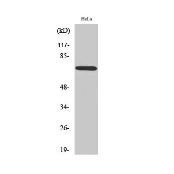  Western Blot analysis of HeLa cells using ABCF2 Polyclonal Antibody