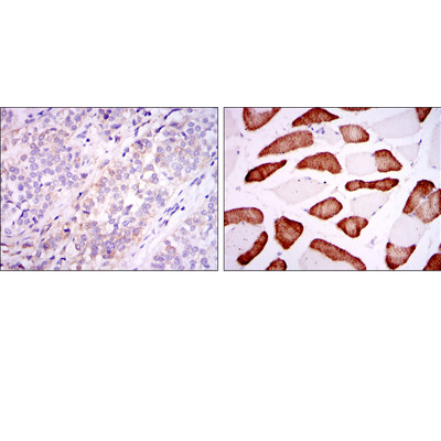  Immunohistochemistry analysis of paraffin-embedded bladder cancer tissues (left) and skeletal muscle tissues (right) with DAB staining using ABCG2 Monoclonal Antibody.