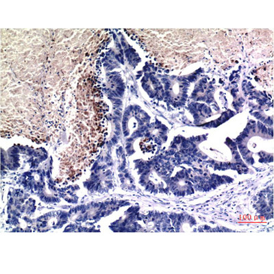 Immunohistochemical analysis of paraffin-embedded Human Stomach Tissue using Acetyl Histone H3 K9 Mouse mAb diluted at 1:200.