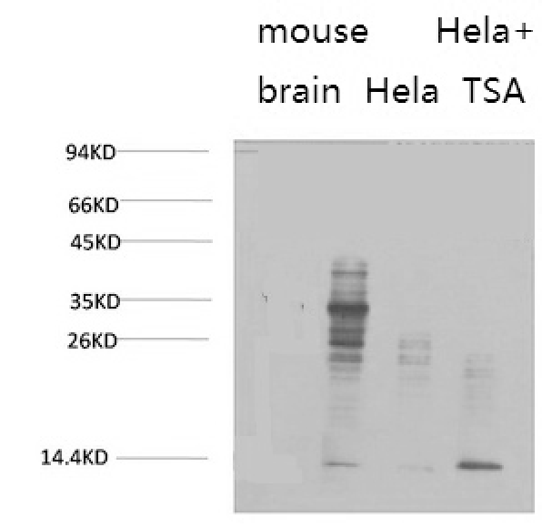  Western blot analysis of 1) Mouse Brain Tissue, 2) Hela, 3) Hela+TSA Treated using Acetyl Lysine Monoclonal Antibody.