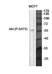 Akt (phospho Ser473) Polyclonal Antibody